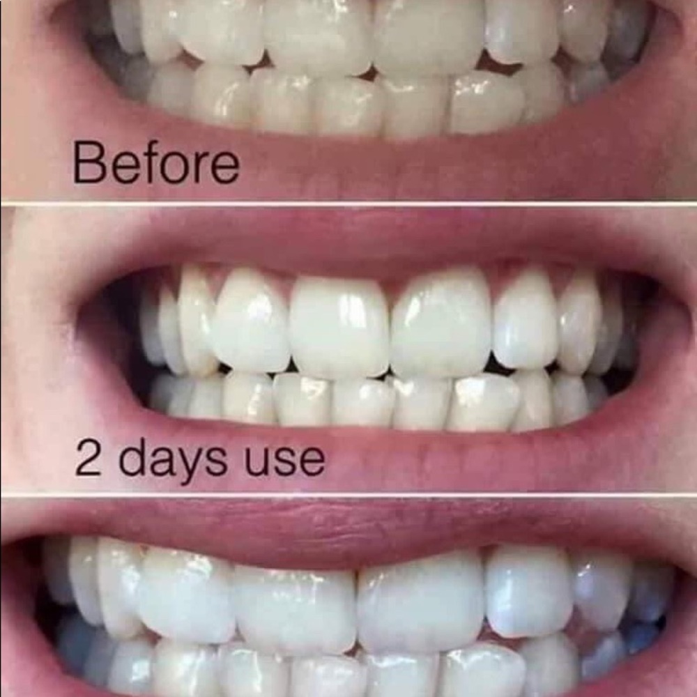 Whitening Toothpaste - Picture 2 of 2
